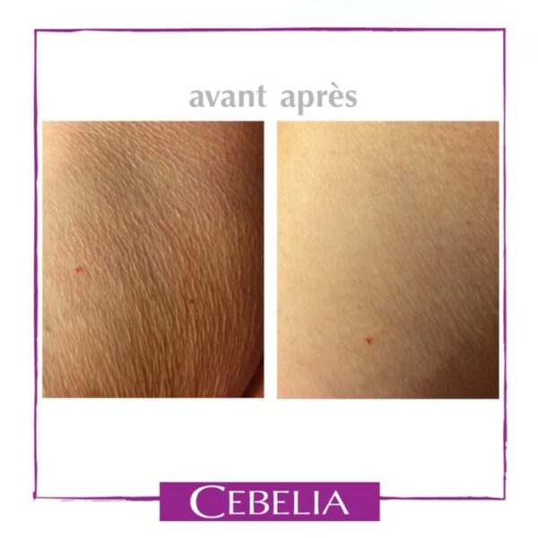 Cebelia Lait apaisant (corps et jambes) 290 ml